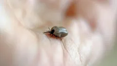 皮膚についたダニ：咬まれた後の対処法と相談先